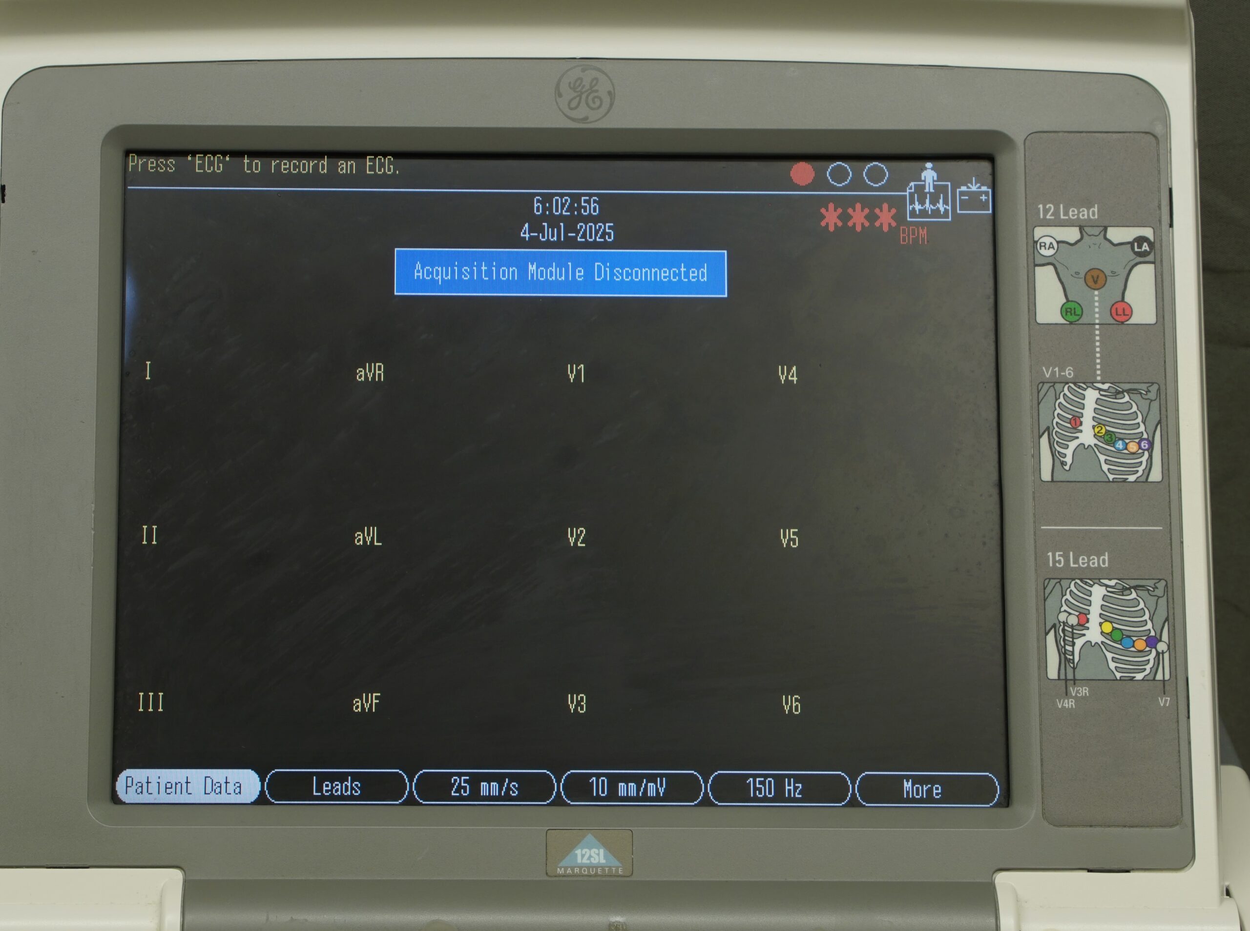 DSS05925